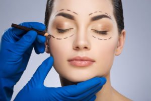 blefaroplastia