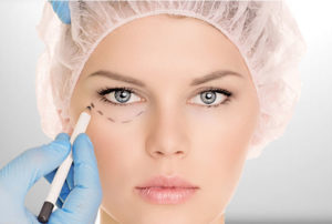 blefaroplastia