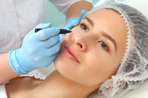 blefaroplastia3