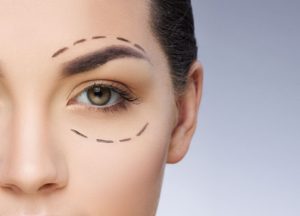 idade certa para fazer blefaroplastia