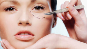 cicatrização após a blefaroplastia