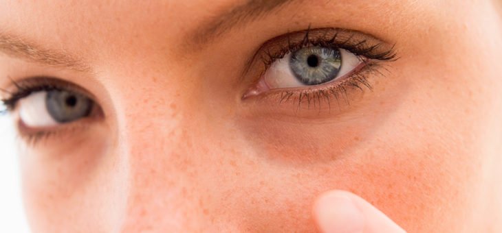 6 Motivos e Soluções para as Olheiras