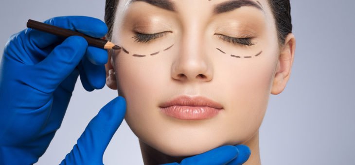 Blefaroplastia: tudo sobre a cirurgia das pálpebras