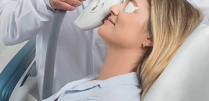 Luz Pulsada para Inflamação nas pálpebras: Tudo que Você Precisa Saber