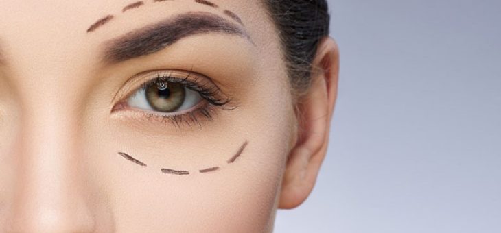 Existe idade certa para fazer a blefaroplastia?