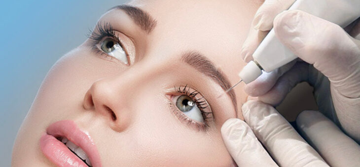 Blefaroplastia sem cortes: para quem é indicada e quando fazer